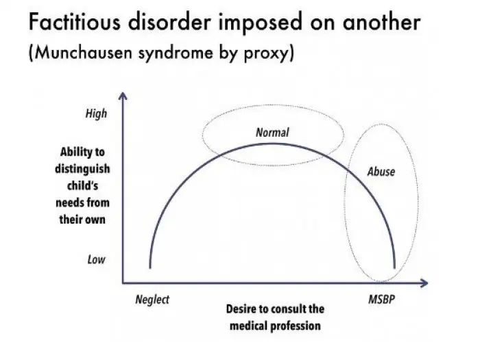 Factitious disorder