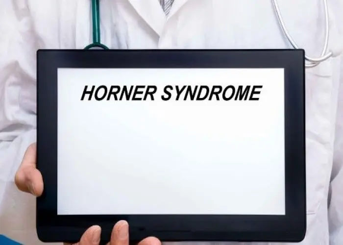 Horner syndrome
