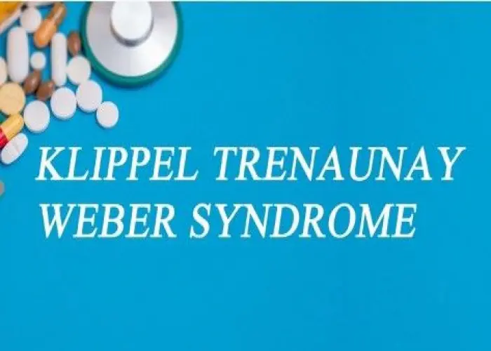 Klippel-Trenaunay syndrome