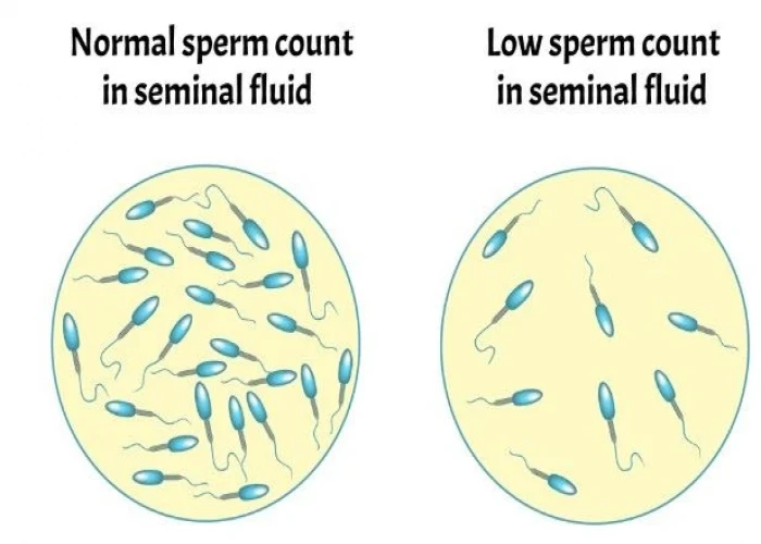 Low sperm count