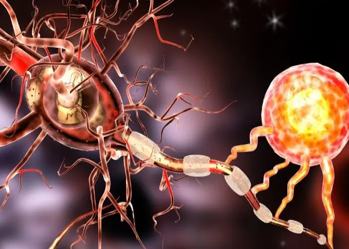 Peripheral nerve tumors