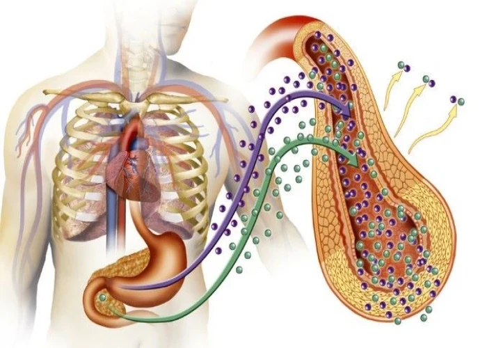 Pheochromocytoma