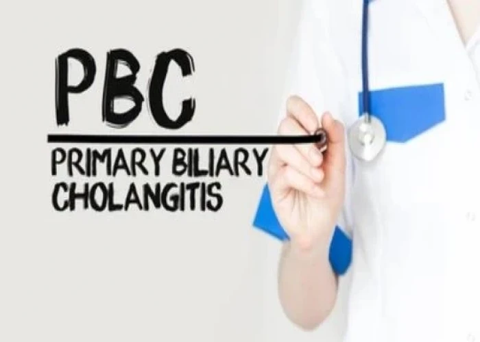 Primary biliary cholangitis