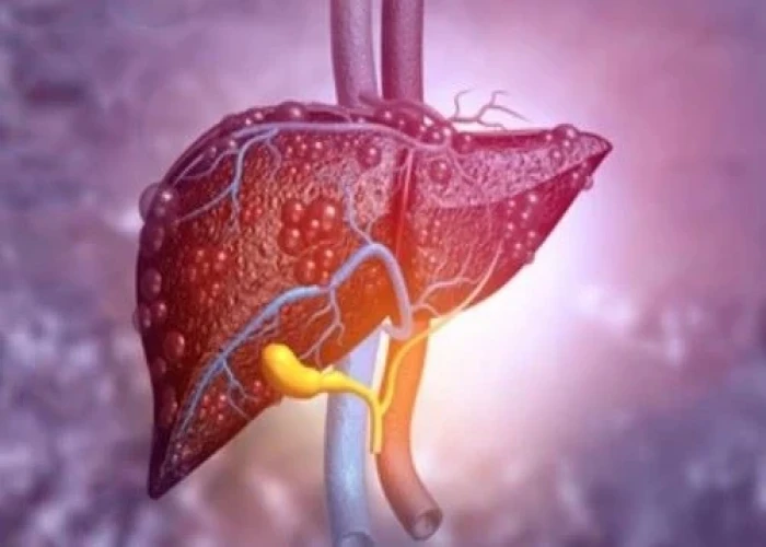 Primary sclerosing cholangitis