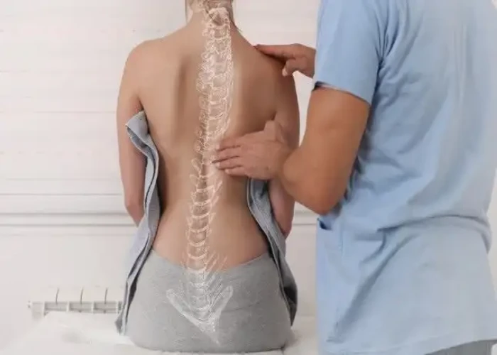 Scoliosis