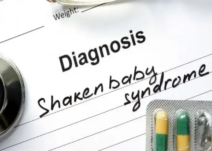 Shaken baby syndrome