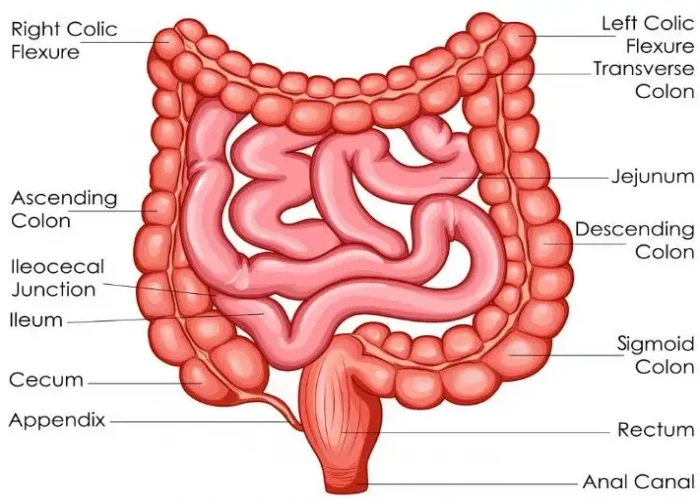 Small bowel prolapse (enterocele)