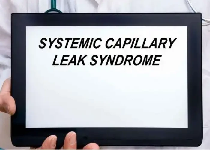 Systemic capillary leak syndrome