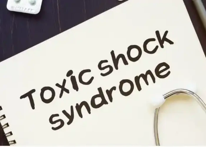 Toxic shock syndrome