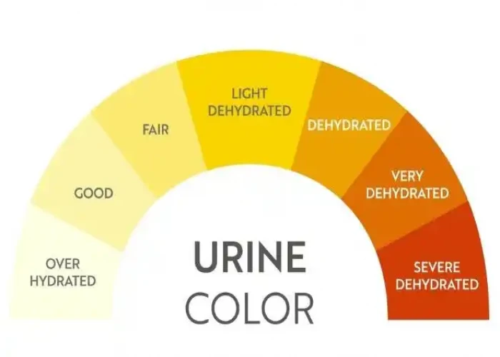 Urine color