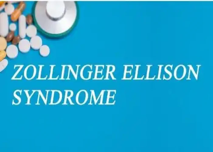 Zollinger-Ellison syndrome