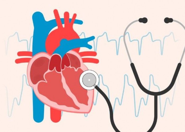 Patent Foramen Ovale