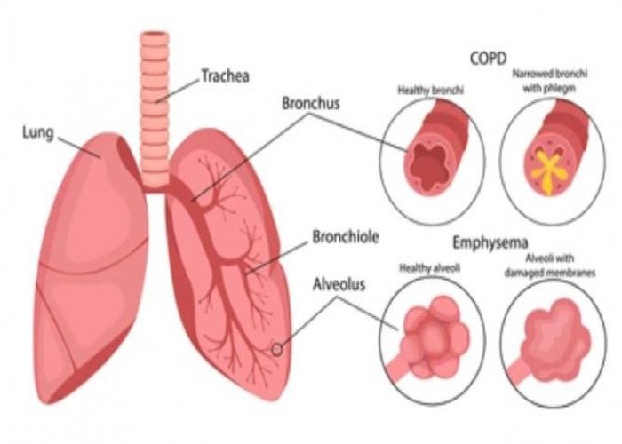 Bronchi