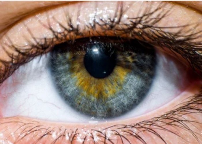 Cornea Eye