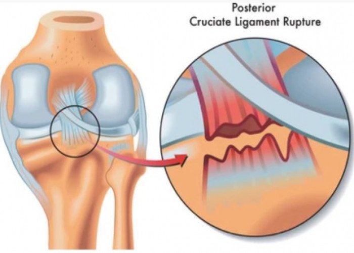 Ligaments