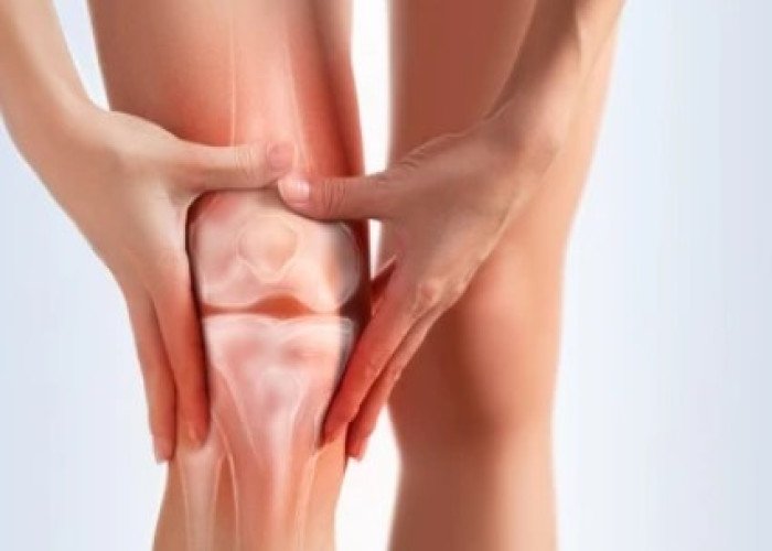 Arthritis in the knee