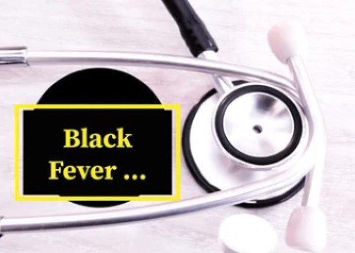 Black fever