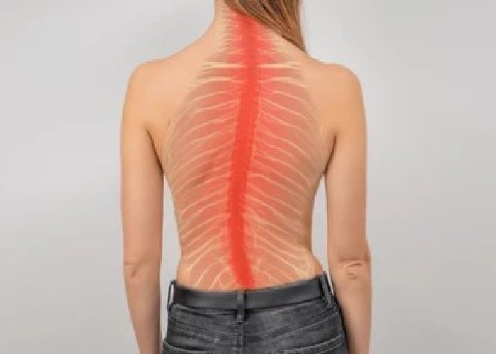 Spine is curved
